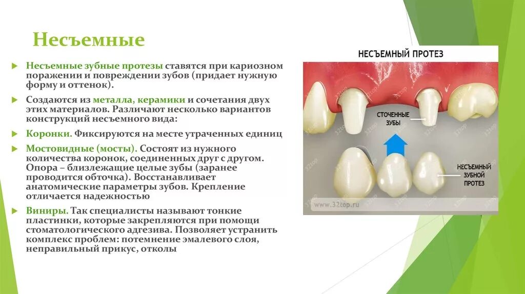 Классификация видов несъемных протезов. Классификация несъемных протезов ортопедическая стоматология. Классификация съемных протезов. Классификация протезов в ортопедической стоматологии. Какую функцию выполняет коронка зуба