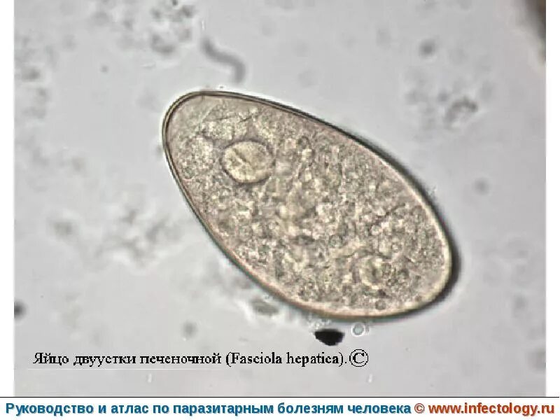Печеночный сосальщик под микроскопом. Яйца гельминтов fasciola hepatica. fasciola hepatica яйца. яйца печеночного сосальщика микроскоп. яйца печеночной двуустки.