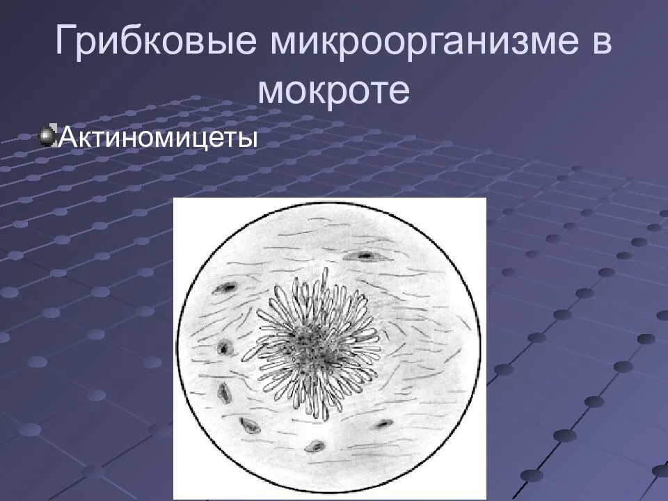 Мокрота какие бактерии