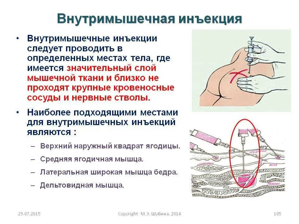 Также можно вводить. Методика внутримышечной инъекции. Постановка внутримышечной инъекции алгоритм. Техника выполнения внутримышечной инъекции алгоритм. Техника постановки ВМ инъекции.