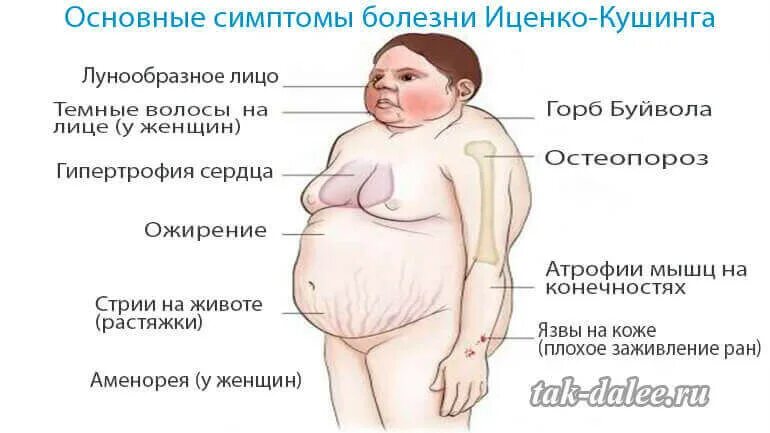 1. Жалобы при болезни Иценко-Кушинга весьма характерны