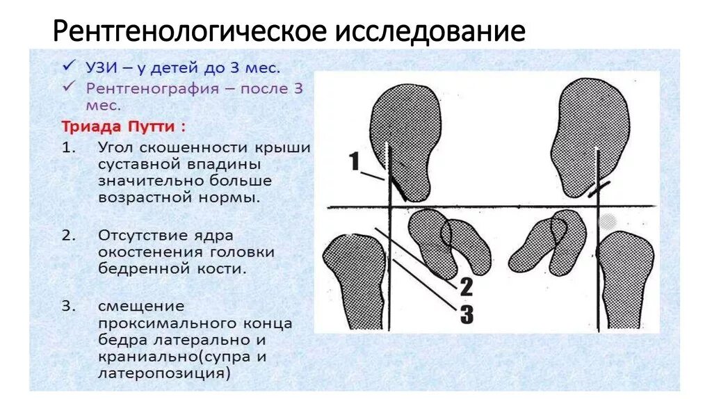 Угол шарпа