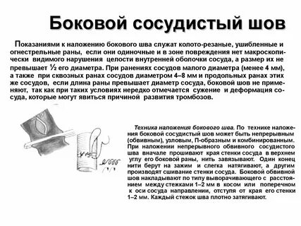 Основные виды сосудистого шва
