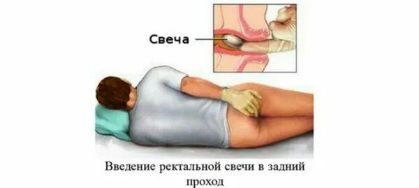 Как правильно вставить свечи ректально взрослому фото ИХТИОЛ СВЕЧИ: ИНСТРУКЦИЯ ПО ПРИМЕНЕНИЮ, ЦЕНА, ОТЗЫВЫ. ИХТИОЛОВЫЕ СВЕЧИ: ИНСТРУКЦ