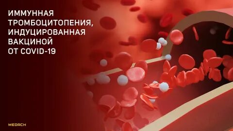 Иммунная тромбоцитопения