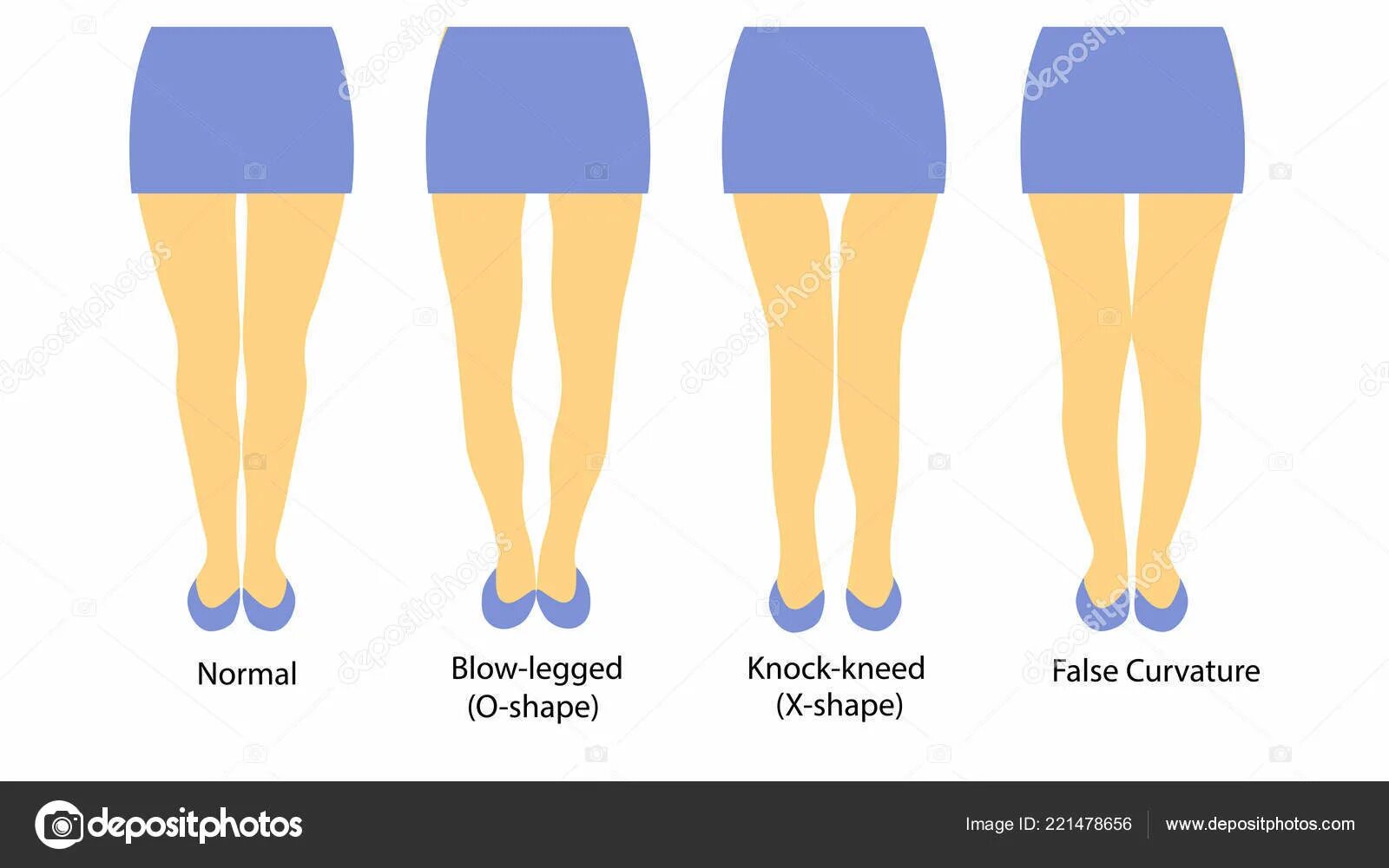 Какие должны быть ноги. Формы женских ног. Форма ног у женщин. Правильная форма женских ног. Типы ног у девушек.