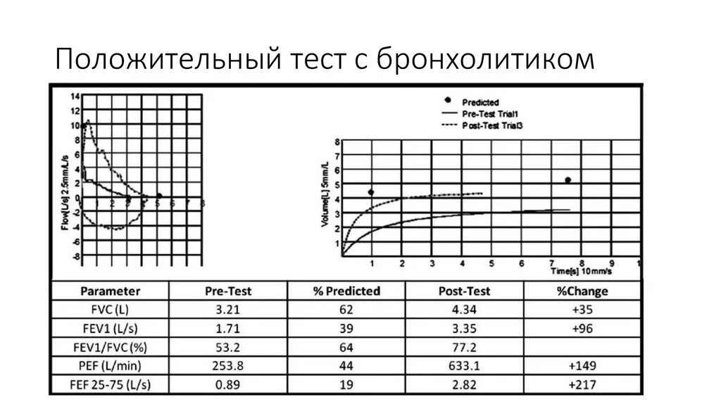 Проба с бронхолитиком отрицательная что это. Спирометрия бронходилатационный тест. проба с бронхолитиком положительная. проба с бронхолитиком проведение. спирометрия при бронхиальной астме показатели.