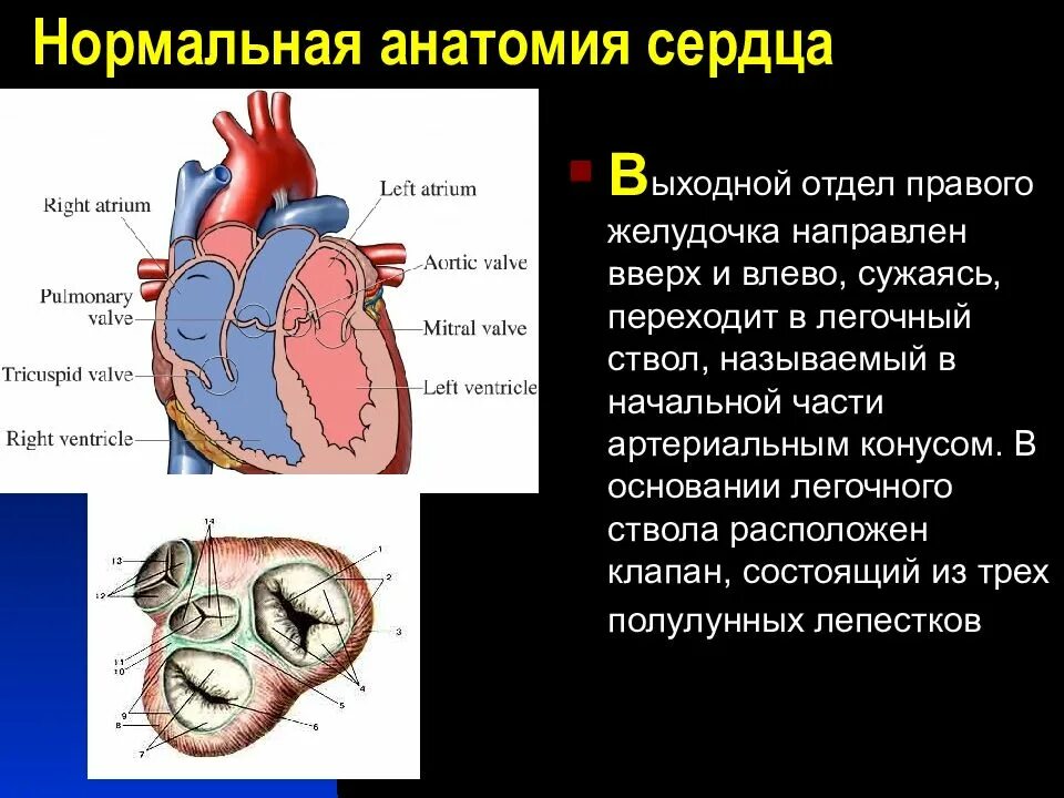 Клапан легочного ствола сердца. Клапан легочного ствола анатомия. клапан легочного ствола латынь. легочный ствол сердца анатомия. полулунные заслонки клапана легочного ствола называются.