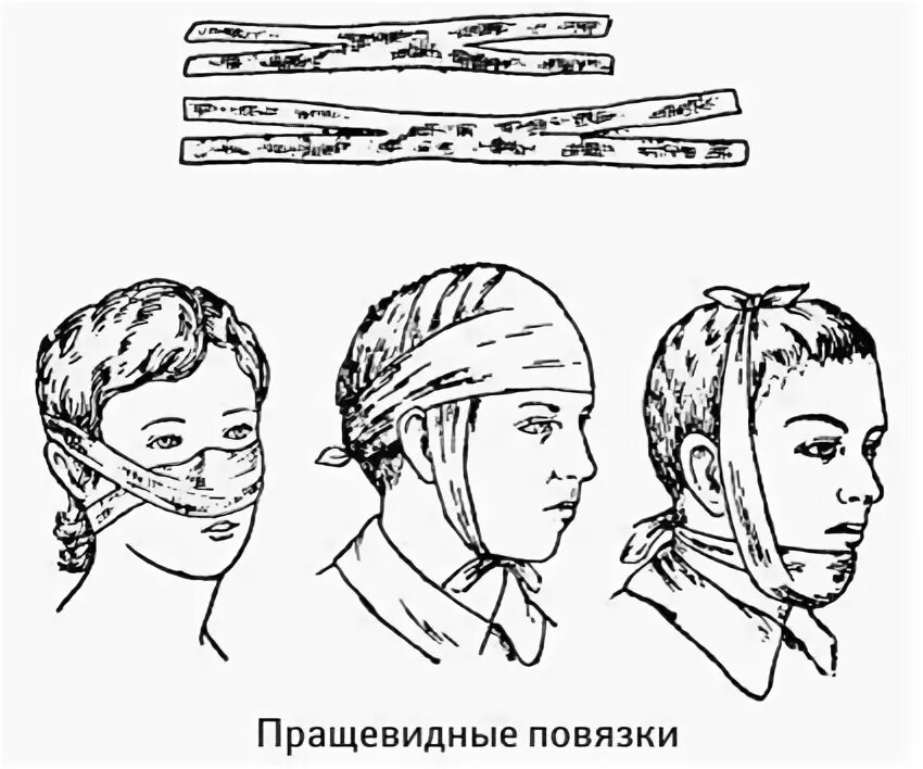 Техника наложения пращевидной повязки. Пращевидная повязка алгоритм. Пращевидная повязка на затылок алгоритм. Пращевидная повязка на нос алгоритм.