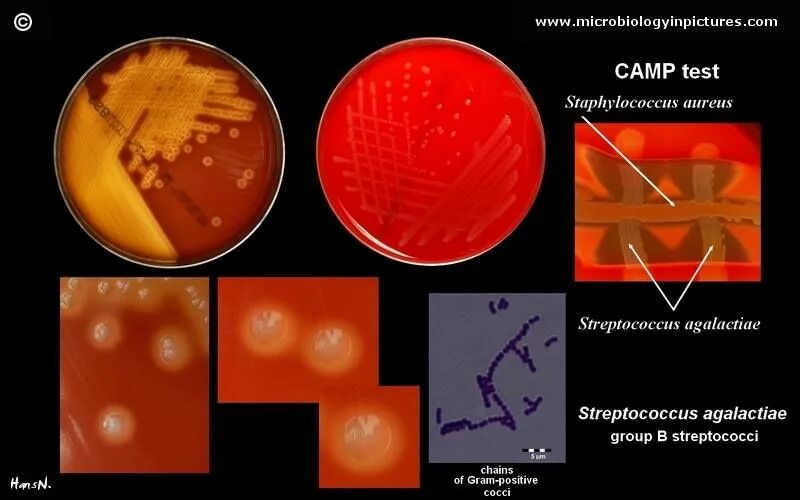 Тест на стрептококки в аптеке. Streptococcus agalactiae микробиология. Streptococcus pyogenes микробиология. Streptococcus agalactiae микроскопия.