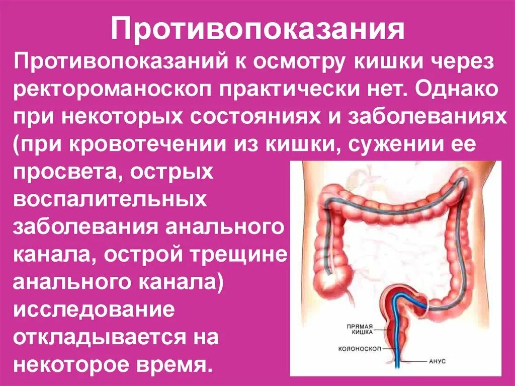 Показания к проведению ректороманоскопии. Противопоказания к ректороманоскопии. Исследование прямой и сигмовидной кишки.