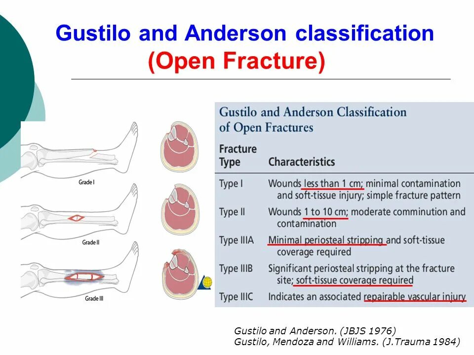 Классификация андерсена. Классификация открытых переломов gustilo. gustilo anderson. классификация гастило. классификация по густило.