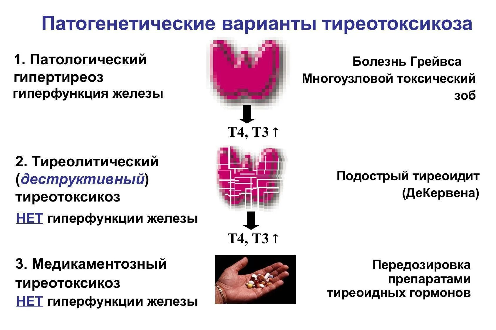 Патогенетическая терапия гипертиреоза. Заболевания щитовидной железы тиреотоксикоз. Тиреотоксикоз и гормон т4. Гормоны щитовидной железы патогенез.