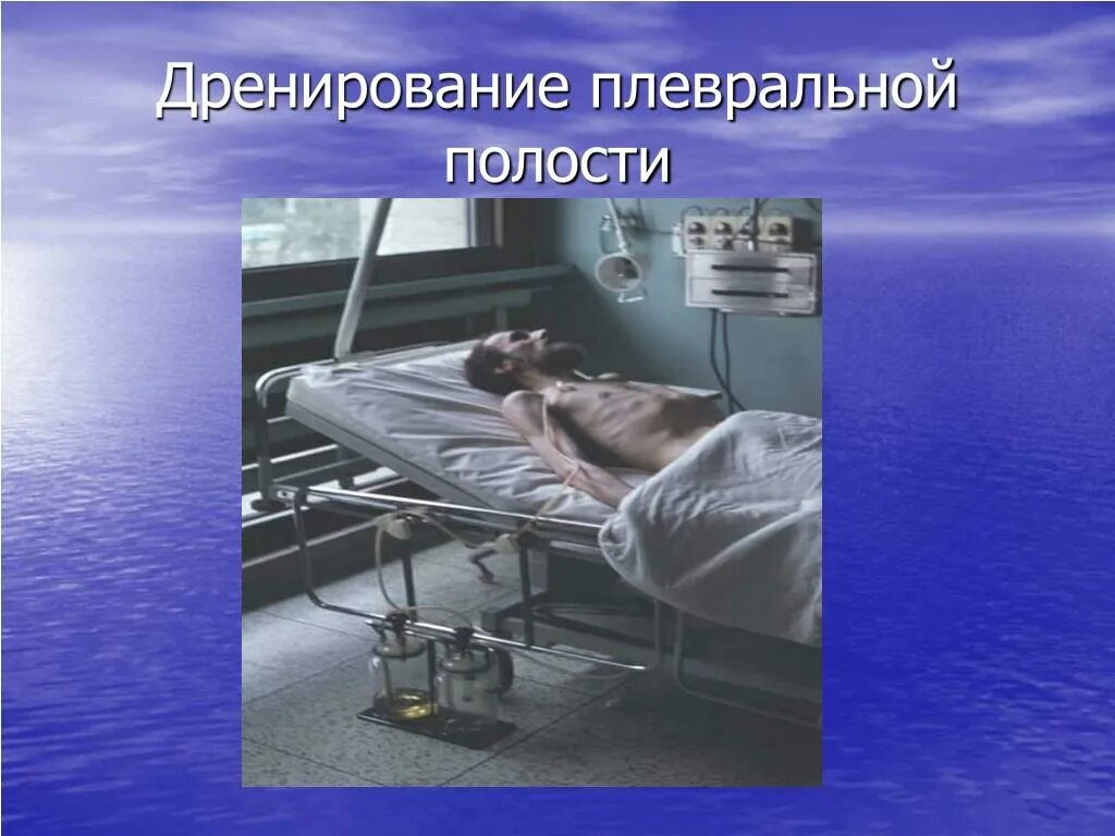 дренирование легкого. схема активной аспирации из плевральной полости. дренирование легкого. дренаж в плевральную полость по белау. дренаж абсцесса легкого.