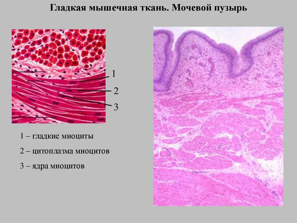 Гладкая мышечная ткань мочевой пузырь продольный и поперечный разрез. Гладкая мышечная ткань гистология. Гладкая мышечная ткань срез стенки мочевого пузыря. Гладкая мышечная ткань мочевого пузыря гистология. Мышечная ткань мочевого пузыря.