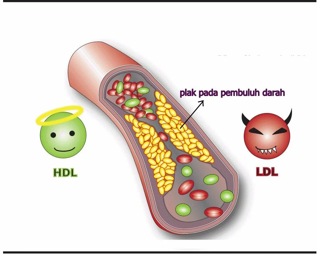 HDL холестерин что это. LDL холестерин что это. Холестерол HDL. Холестерин рисунок.