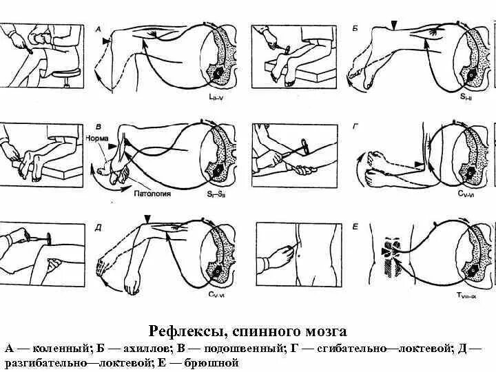 Глубокие сухожильные рефлексы. Сухожильные рефлексы неврология. Ахиллов рефлекс дуга. 5 Основных сухожильных рефлексов.