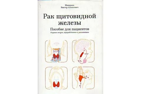 Отзывы после рака щитовидной железы