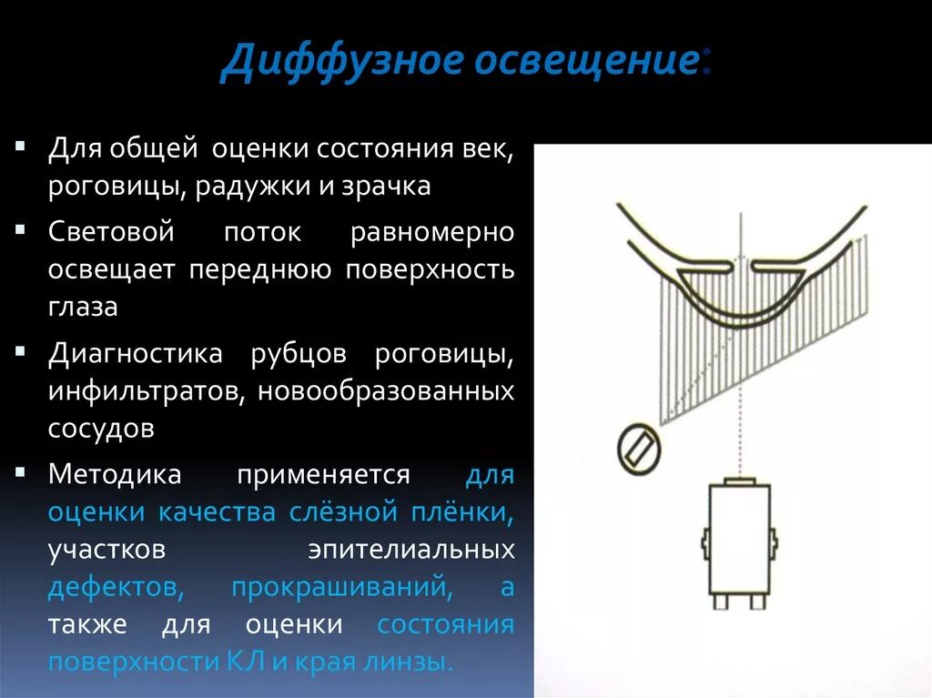 Диффузный сигнал. Диффузное освещение. Диффузное освещение глаза. Диффузное и фокальное освещение. Диффузное освещение для технического зрения.