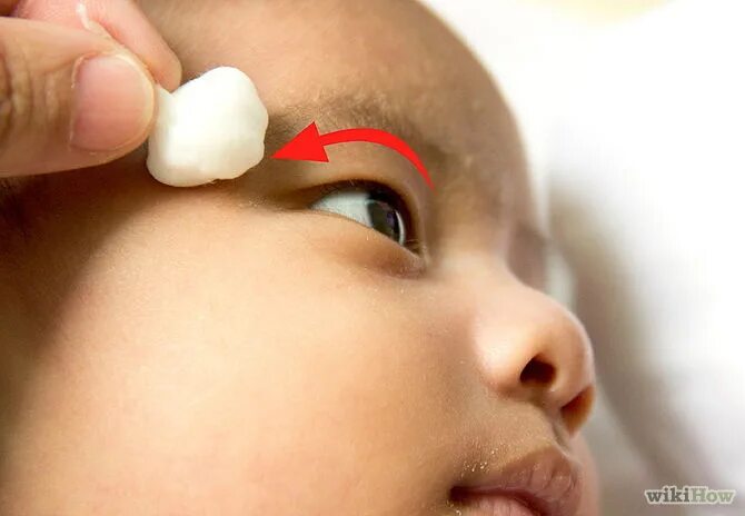 Чем обработать глаза новорожденному. Протирание глаз новорожденного. Умывание глаз новорожденного. Уход за глазами новорожденного.