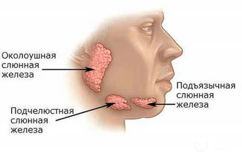 Образование околоушных желез. Воспаление поднижнечелюстной слюнной железы. Припухлость протока слюнной железы. Околоушная слюнные железы анатомия человека. Воспаление околоушной слюнной железы.