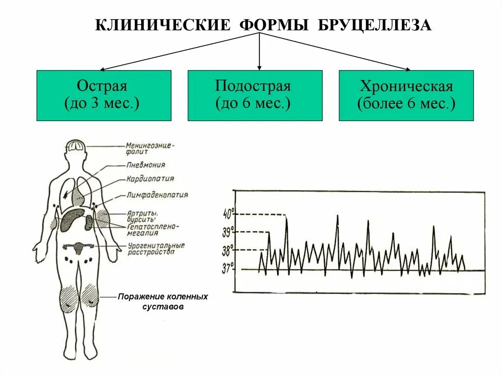 Мальтийская лихорадка у человека симптомы. Виды бруцелл. Бруцеллез животных пути заражения. Бруцеллез клинические проявления. Локомоторная форма хронического бруцеллеза.