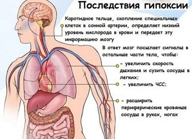 Когда курю кружится голова. Гипоксия. Безкислороднте голодание. Признаки гипоксии.