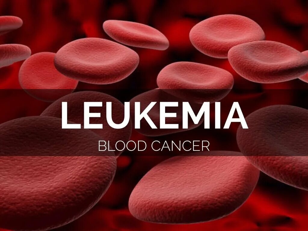 Leukemia. Leukemia