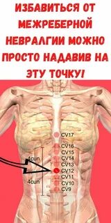 Межреберная невралгия справа спереди у женщин
