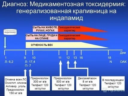 Крапивница тест с ответом