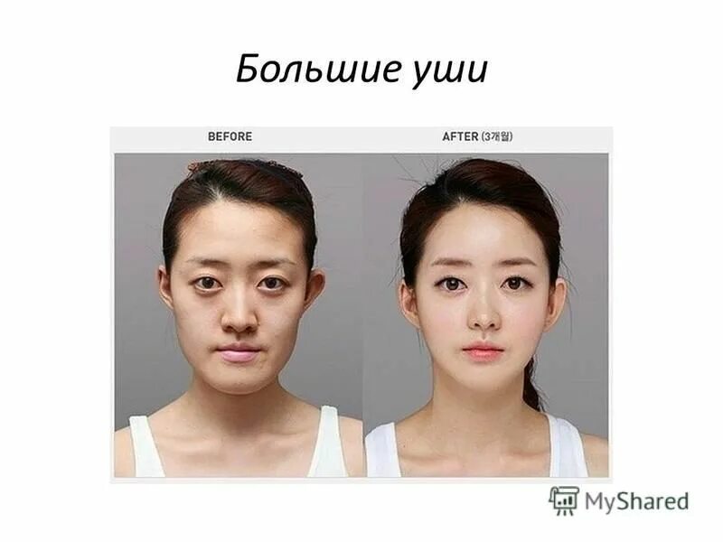 женские стандарты красоты в корее. тест на кск корейские стандарты красоты. идеал красоты в северной корее. Aegyo sal. эталон женской красоты в корее.