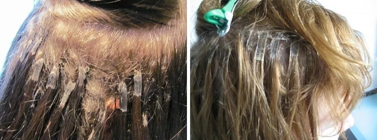 Выпадают нарощенные волосы. Последствия наращивания волос. Некачественное наращивание волос. Капсулы нарощенных волос. После нарощенных волос.
