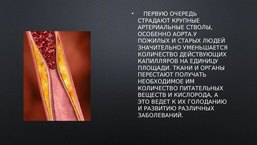 Сосуды у пожилых. Диаметр аорты у молодых и у пожилых.
