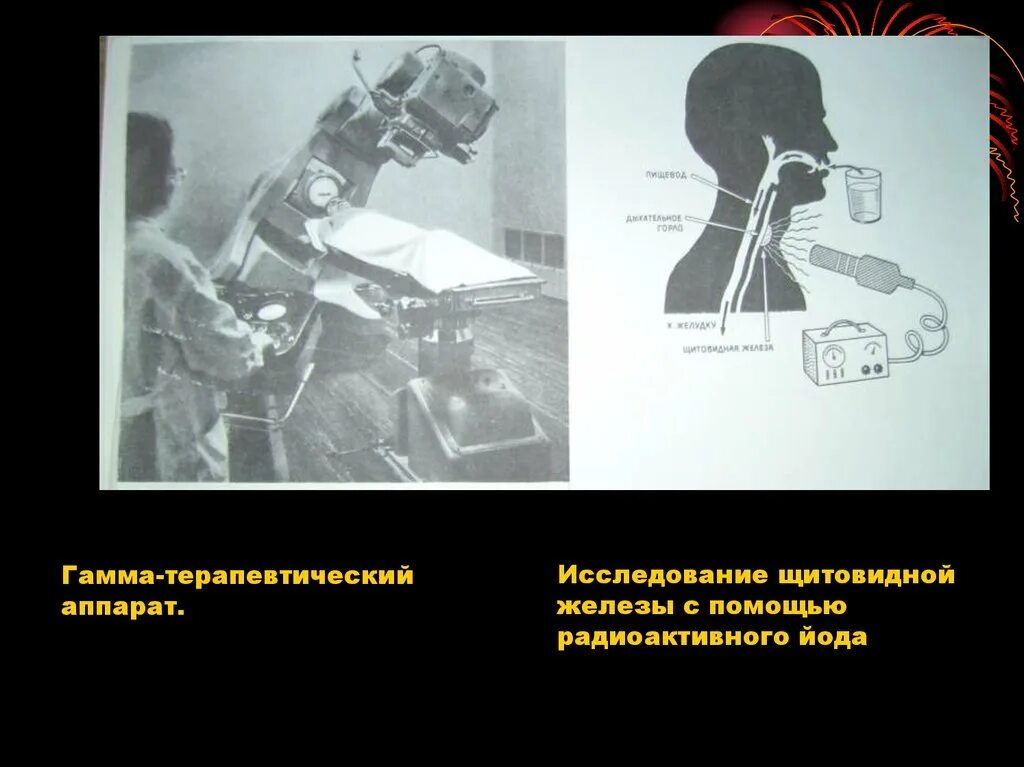 Гамма-терапевтический аппарат. Применение радиоактивных изотопов. Получение радиоактивных изотопов. Радиоактивная инъекция.