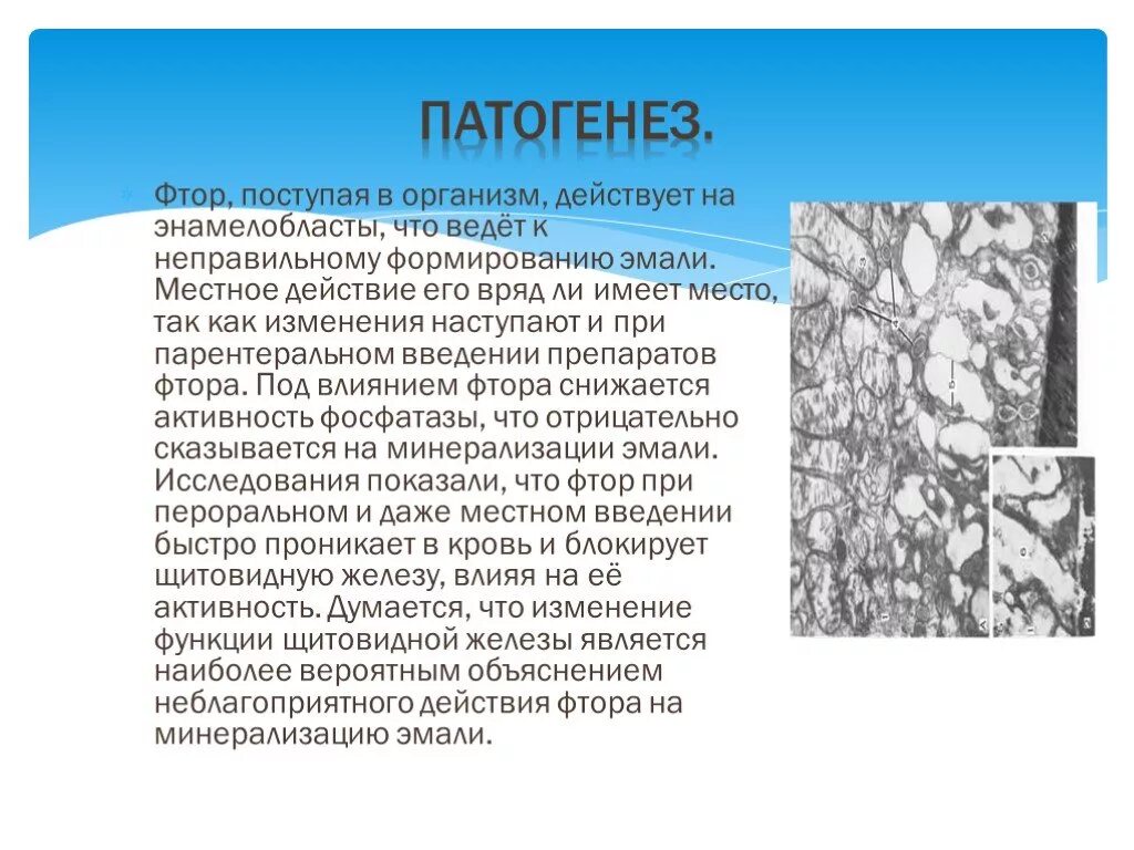 Этиология флюороза. Эндемический флюороз этиология. Этиология флюороза. Флюороз классификация мкб. Причина эндемического флюороза.