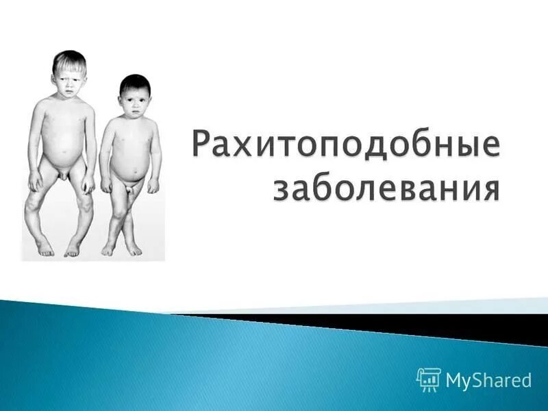 Наследственные заболевания рахит. Наследственные заболевания рахит. Гипофосфатемический витамин-d-резистентный рахит. Витамин д – резистентный рахит (гипофосфатемический рахит). Наследование рахита.