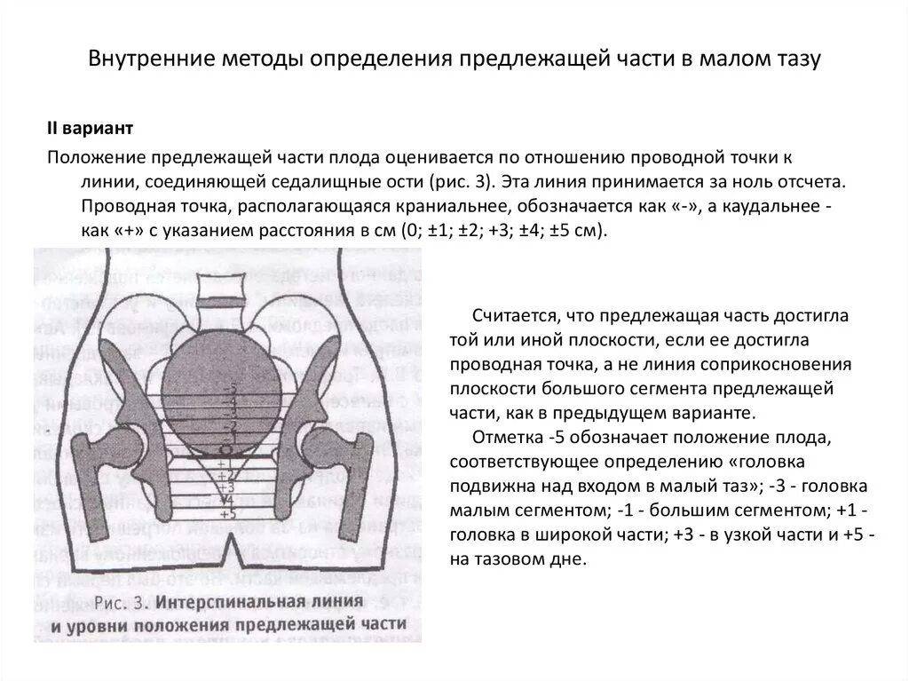 Признак пискачека. Отношение головки к плоскостям малого таза. Способы измерения малого таза. Измерение таза алгоритм. Сегменты таза.