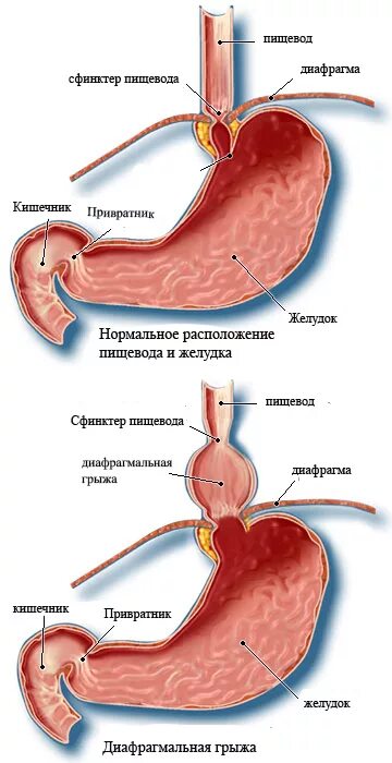 Клапан между желудком и пищеводом. Кардиальный клапан желудка. Кардиальный сфинктер пищевода.