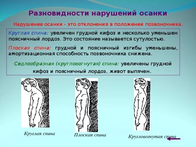 Виды нарушений осанки профилактика нарушений осанки. Виды нарушений осанки профилактика нарушений осанки
