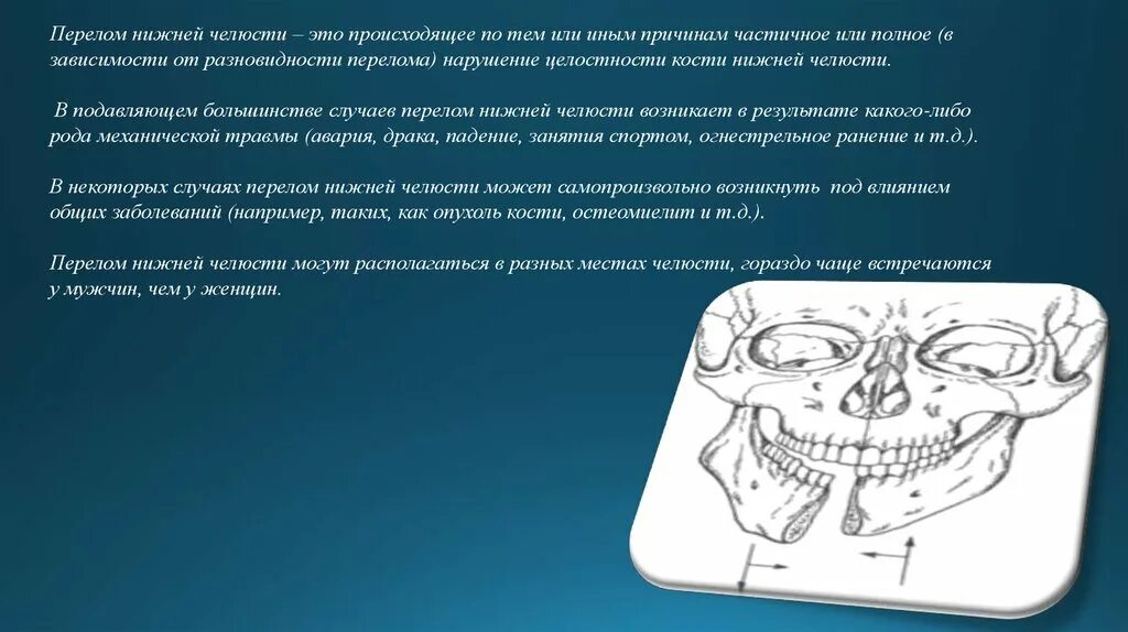 Перелом челюсти код мкб. Перелом челюсти код мкб