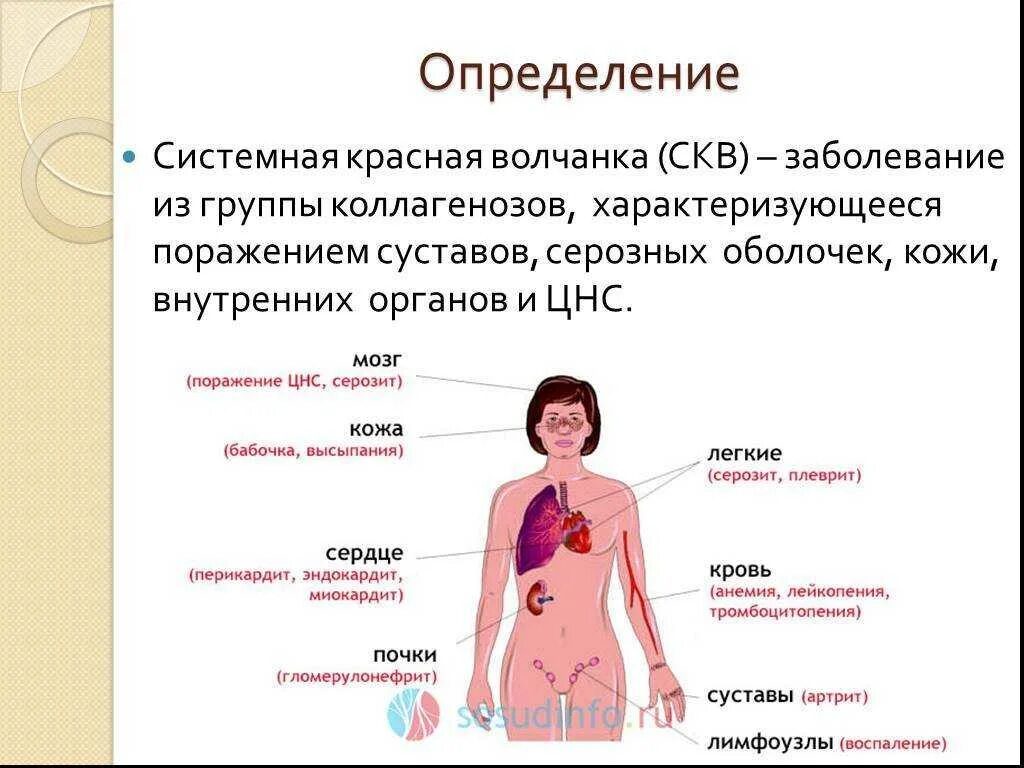 Почему опасно красное. Системная красная волчанка симптомы. Системная красная волчанка поражение органов. Системная красная волчанка дискоидная симптомы.