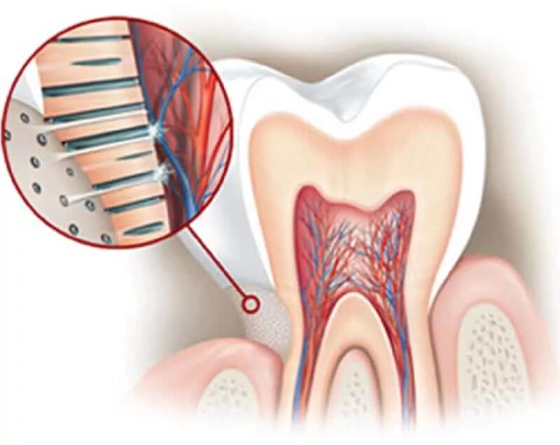 Почему чувствительность зуба. Гиперестезия твердых тканей зубов. Гиперестезию эмали и дентина.