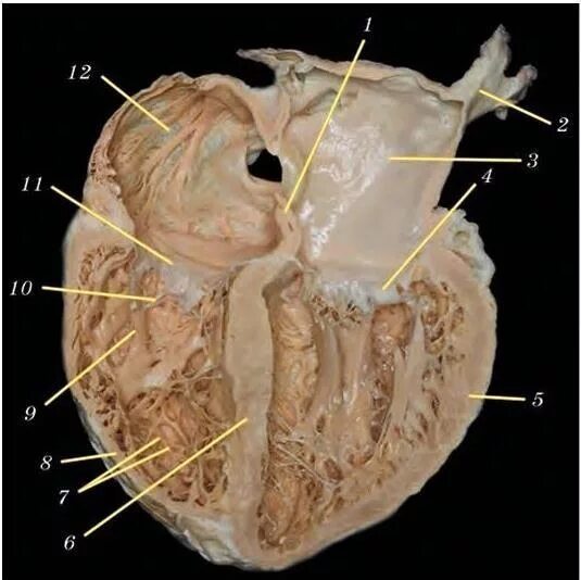 Срез сердца человека. Сердце препарат анатомия. Сердце в разрезе препарат. Сердце АВ разрезе человека. Строение сердца препарат.
