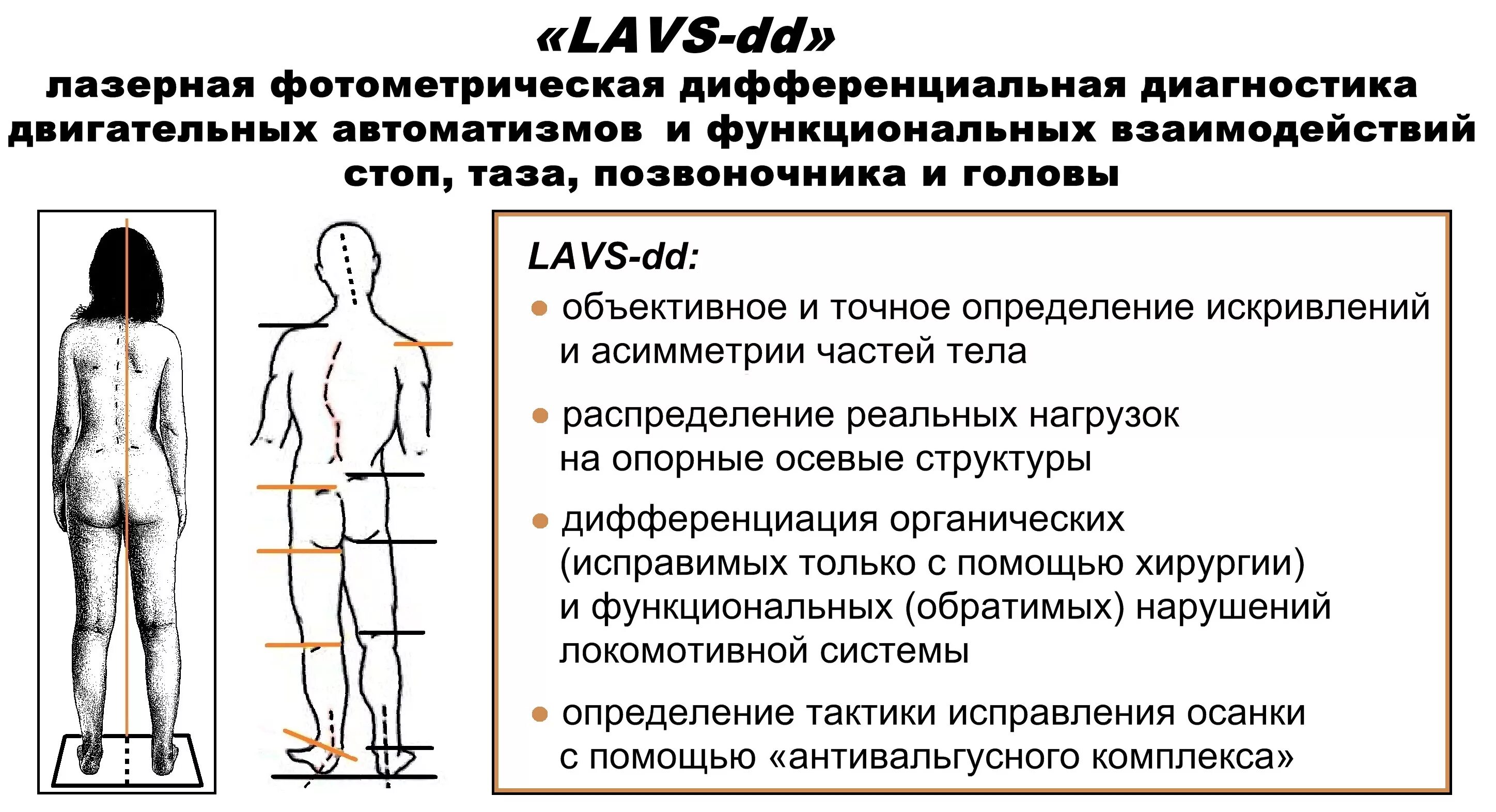 Можно ли исправить сколиоз 2 степени. Искривление позвоночника и таза. самодиагностика сколиоза. функциональная деформация позвоночника. методы диагностики сколиоза.