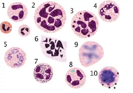 патология ядра патология цитоплазмы. изменение ядра клетки при некрозе. патология ядра клетки. патология ядра патология цитоплазмы. признаки поврежденного ядра.