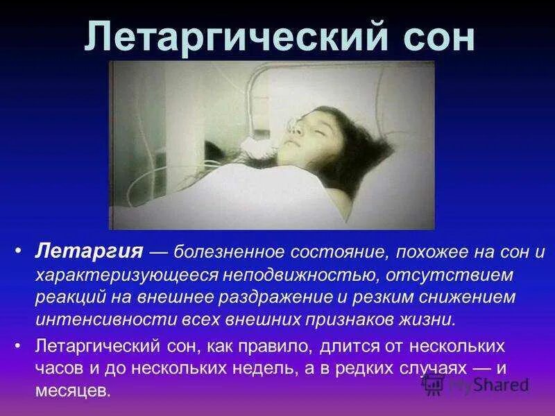 Синдром воскрешения