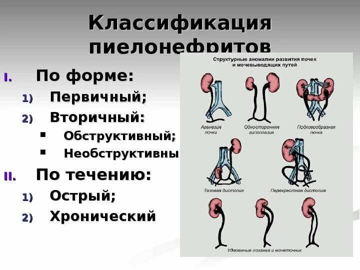 Хронический пиелонефрит с рефлюксом. Необструктивный хронический пиелонефрит связанный с рефлюксом. N11.0 необструктивный хронический пиелонефрит связанный с рефлюксом. Обструктивный пиелонефрит и необструктивный разница. Почечные рефлюксы классификация.