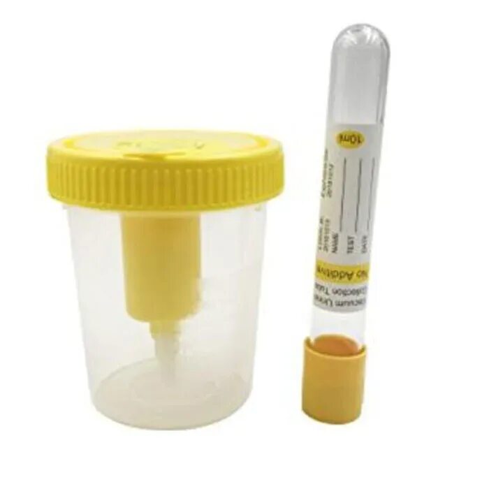 Вакуумный контейнер для мочи. VACUETTE urine Cup - контейнер для мочи. VACUETTE urine Cup - контейнер для мочи (встр.держатель). Контейнер для мочи с адаптером для вакуумных пробирок Россия. Пробирка для сбора посева мочи vacutainer10 мл 16 100 мм bd 455049.