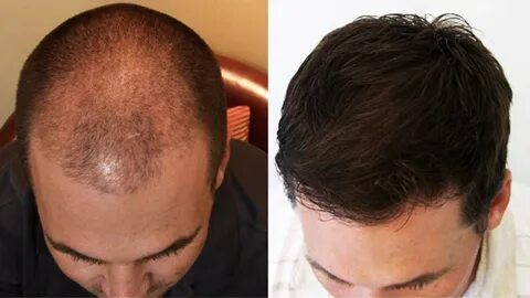 Head after