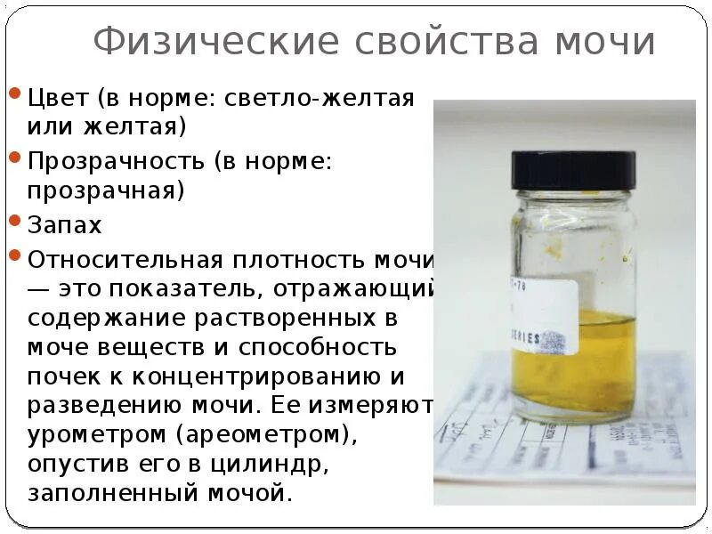 Прозрачность мочи полная что это значит. Физические свойства мочи. цвет мочи и прозрачность в норме. физическое исследование мочи. физические свойства мочи в норме.